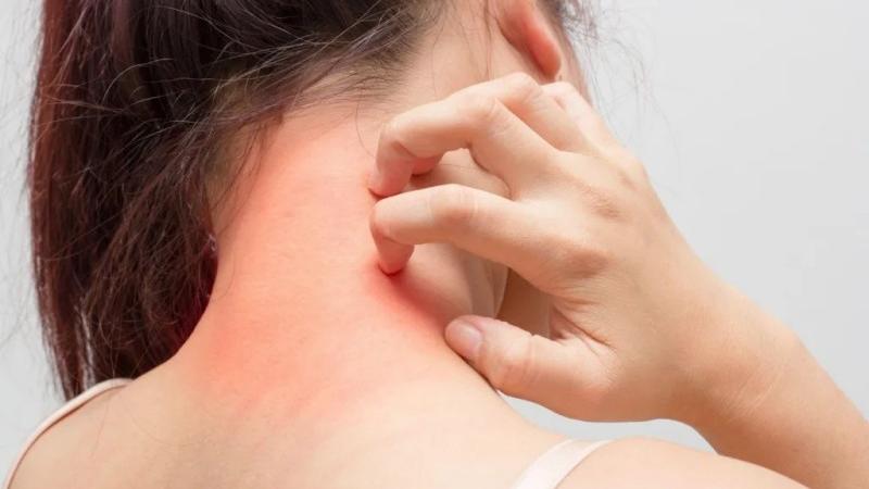 Allergies and the immune system: identification and response